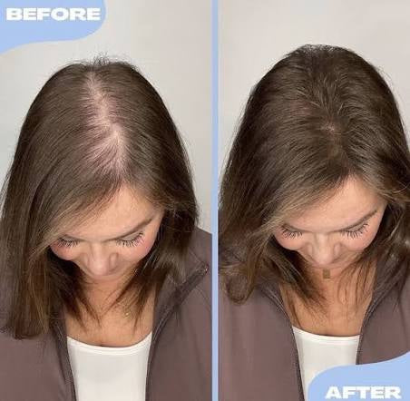 HAIREV Hair Filler | Hair Density Powder