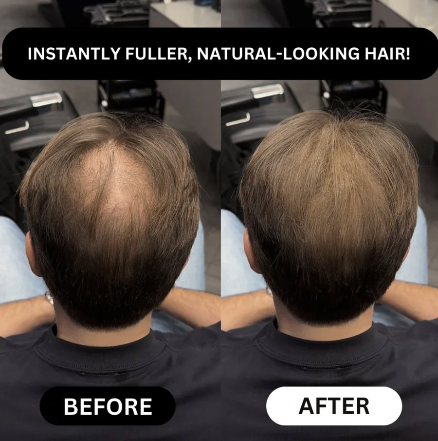 HAIREV Hair Filler | Hair Density Powder 2