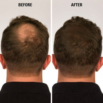 HAIREV Hair Filler | Hair Density Powder