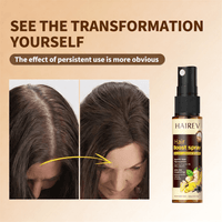 HAIREV™ Hair Boost Spray | Natural Hair Growth Treatment for Thinning Hair 4